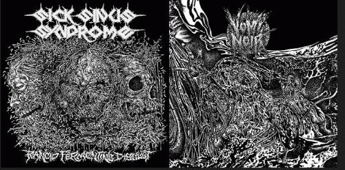 Sick Sinus Syndrome : Rancid Fermenting Disgust - Submersion Emeto​-​Asphyxique